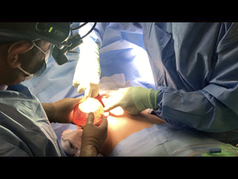 Breast Implant Removal En Bloc