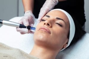 cosmetologist using microneedling on patient