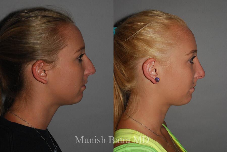 Before and After Image