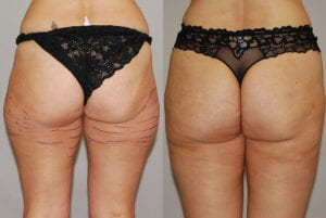 Before and After Image