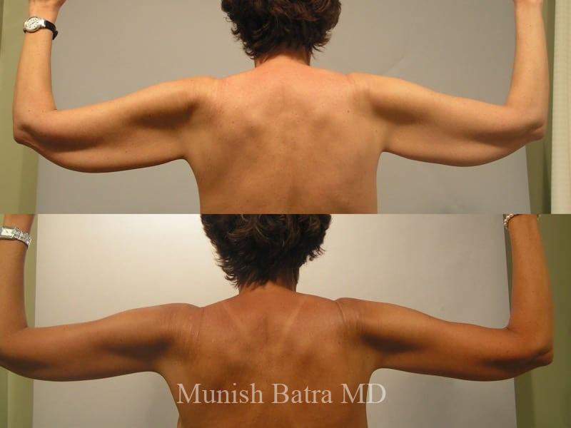 Before and After Image