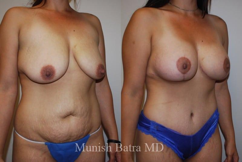 Before and After Image