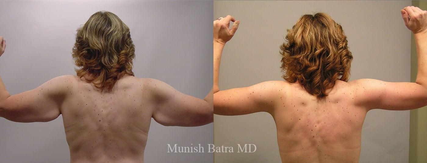 Before and After Image