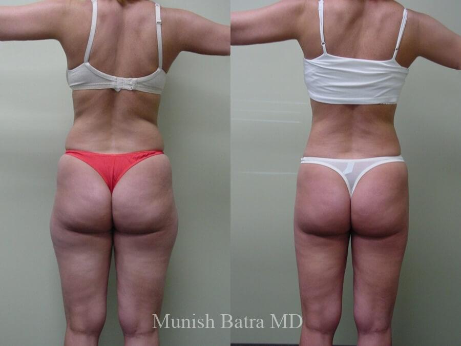 Before and After Image