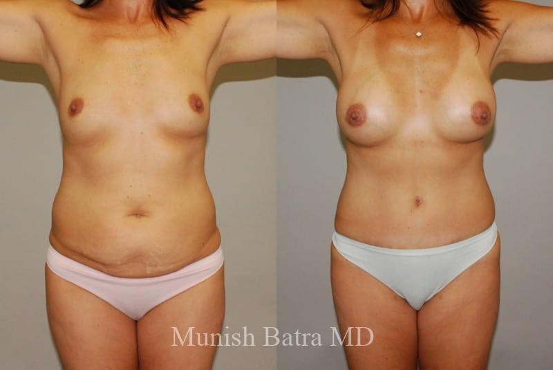 Before and After Image