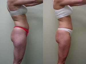 Before and After Image