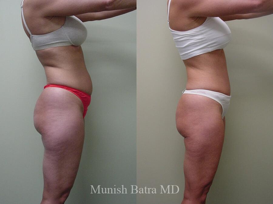 Before and After Image