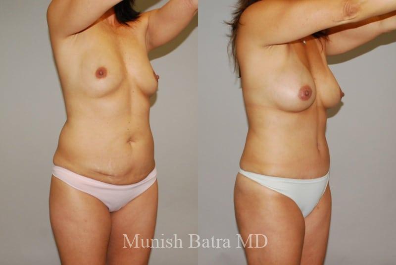 Before and After Image