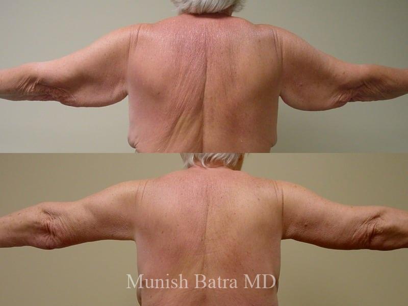 Before and After Image