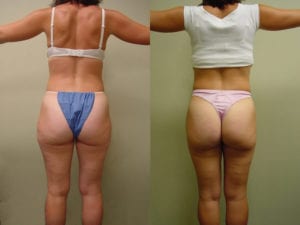 Before and After Image