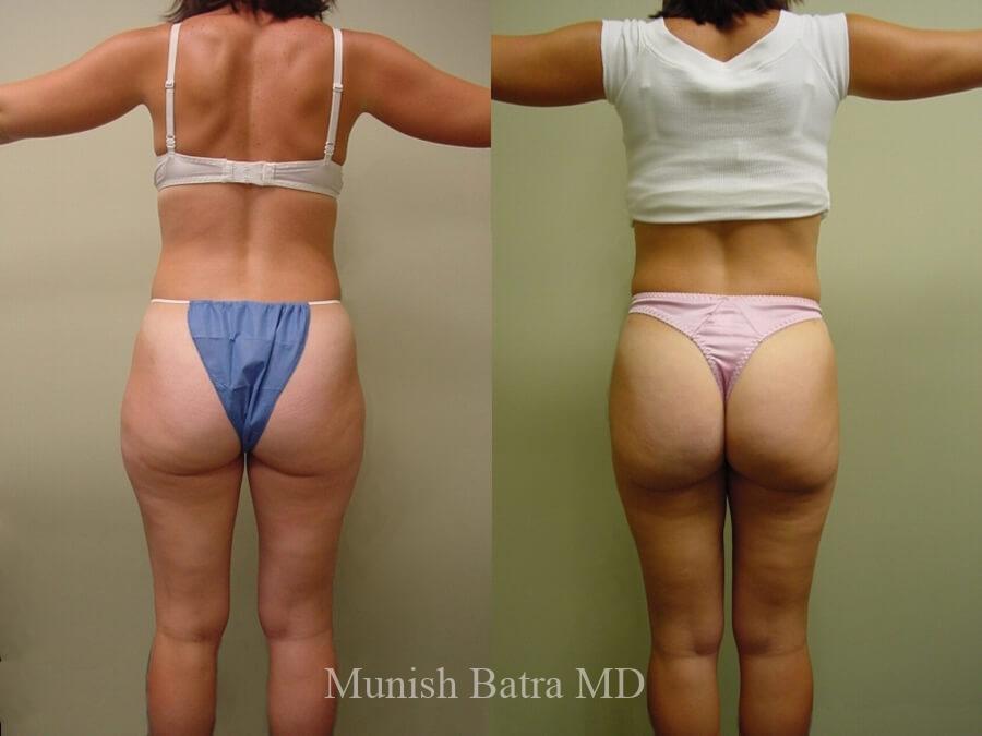 Before and After Image