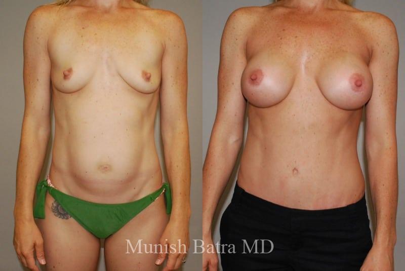 Before and After Image