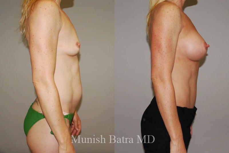 Before and After Image