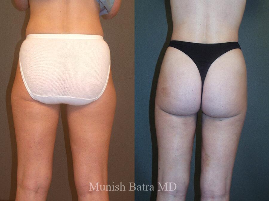 Before and After Image