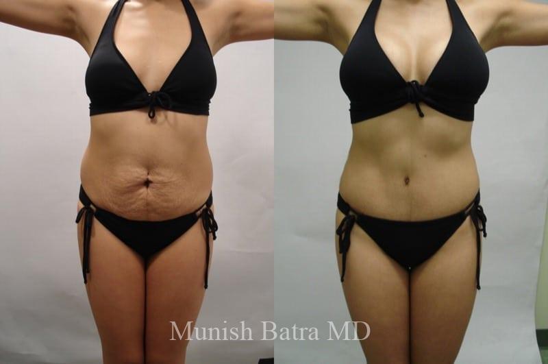 Before and After Image