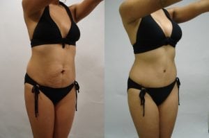 Before and After Image
