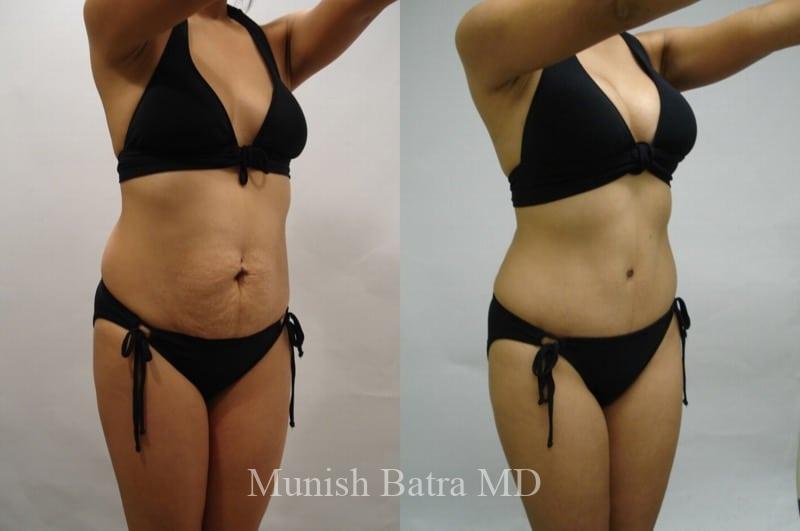 Before and After Image