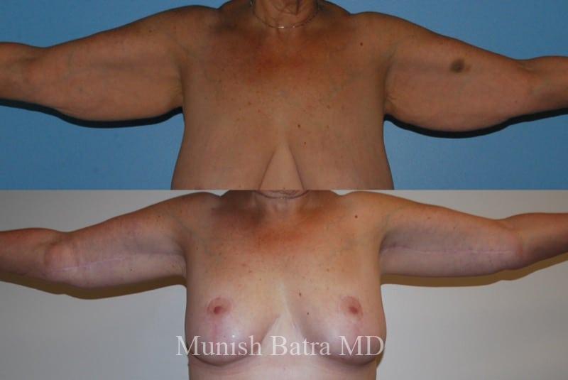 Before and After Image