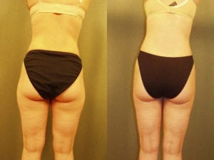 Before and After Image