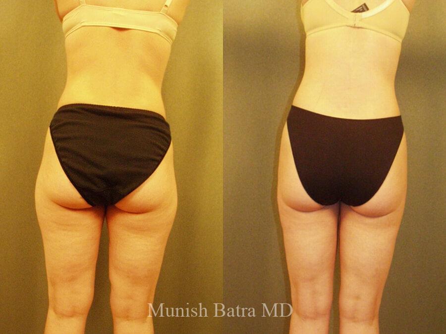 Before and After Image