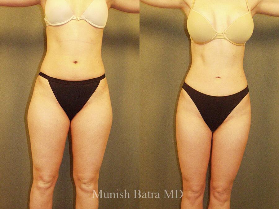 Before and After Image