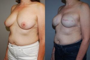 Before and After Image