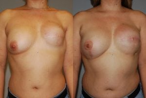 Before and After Image