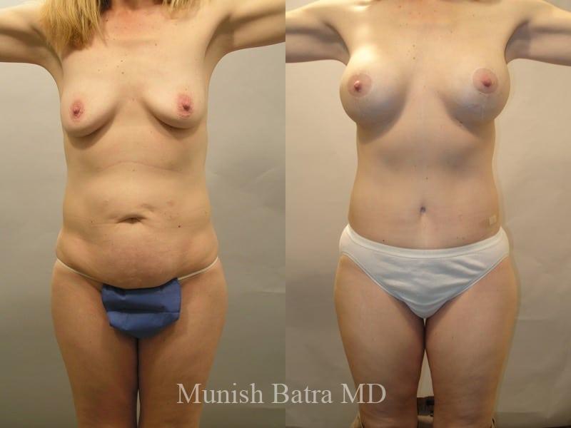 Before and After Image