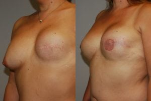 Before and After Image