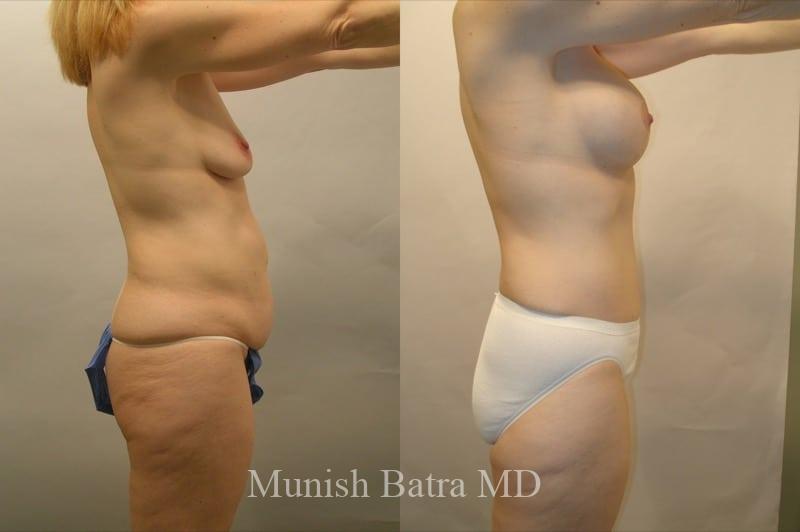 Before and After Image