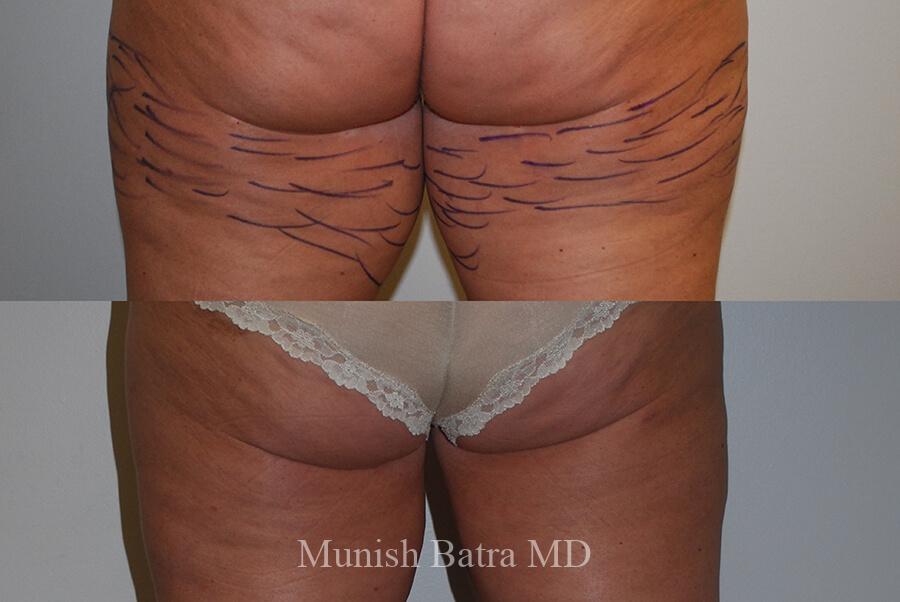 Before and After Image