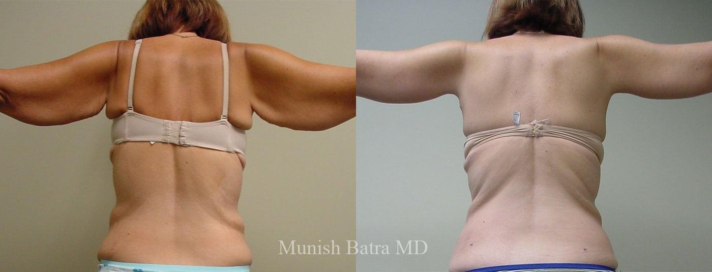 Before and After Image