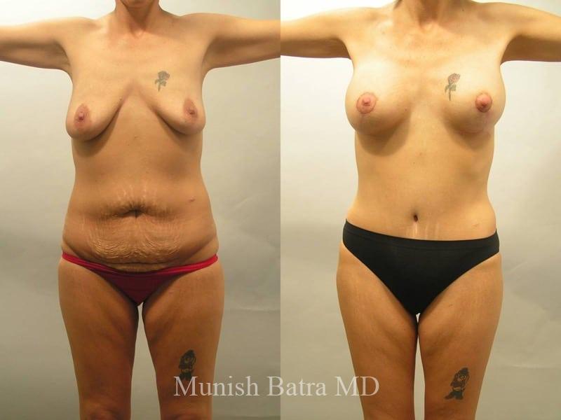 Before and After Image