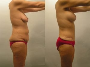 Before and After Image