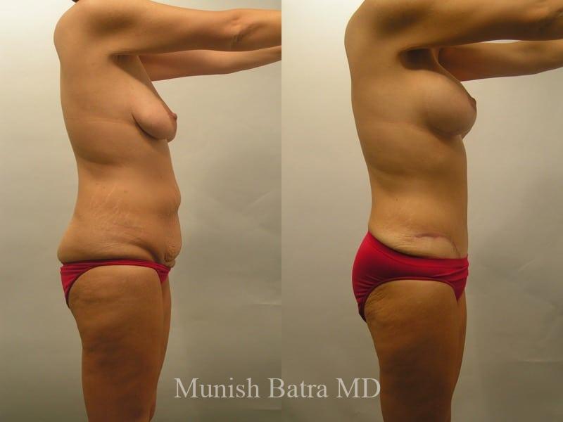 Before and After Image