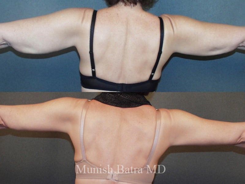 Before and After Image