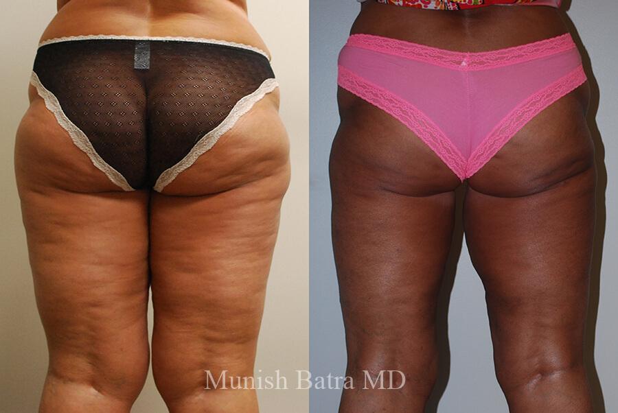 Before and After Image