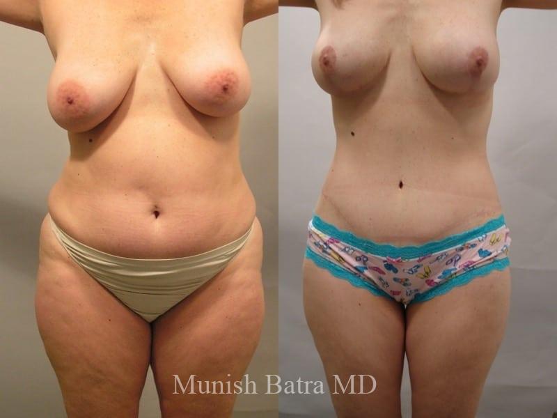Before and After Image