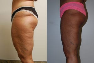 Before and After Image