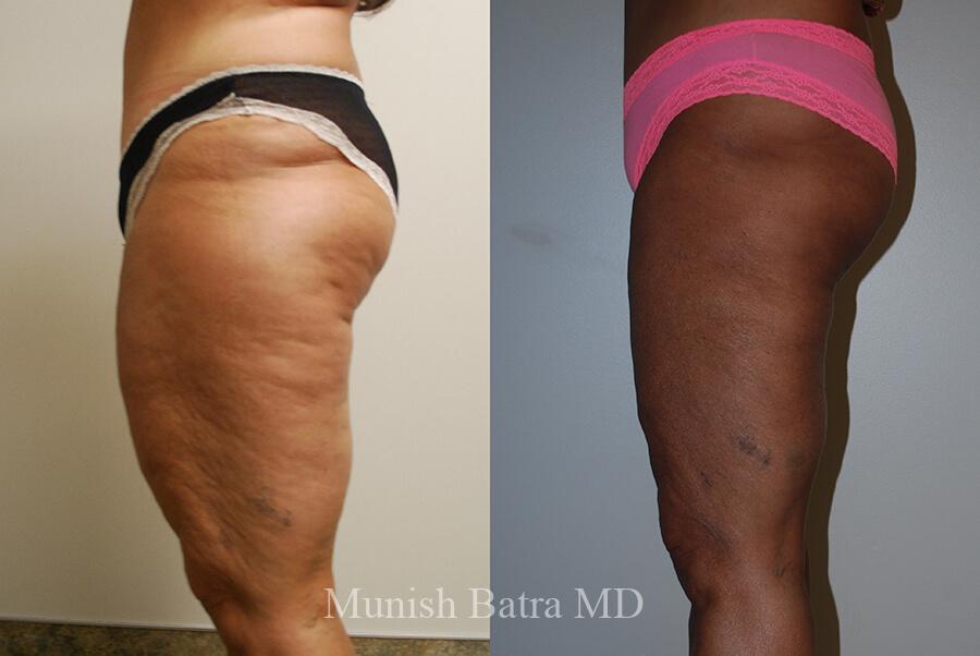 Before and After Image
