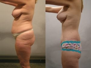 Before and After Image