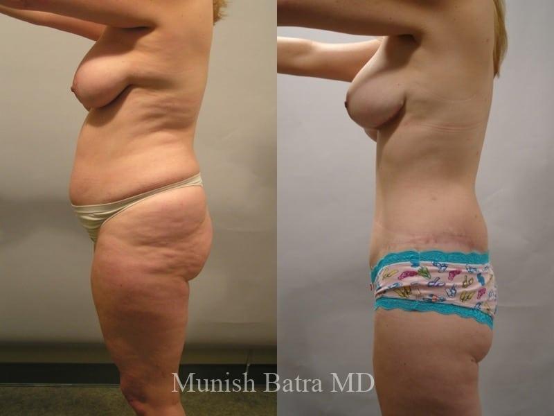 Before and After Image