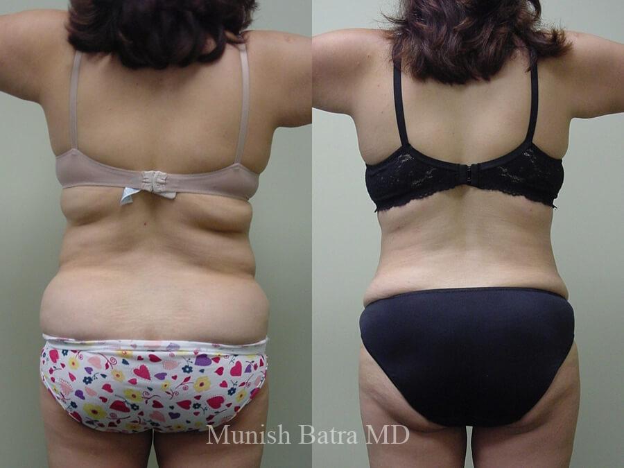 Before and After Image