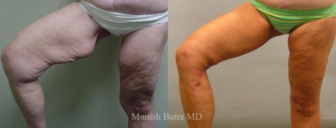 Before and After Image