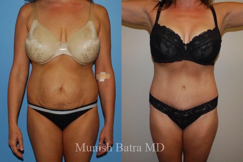 Before and After Image