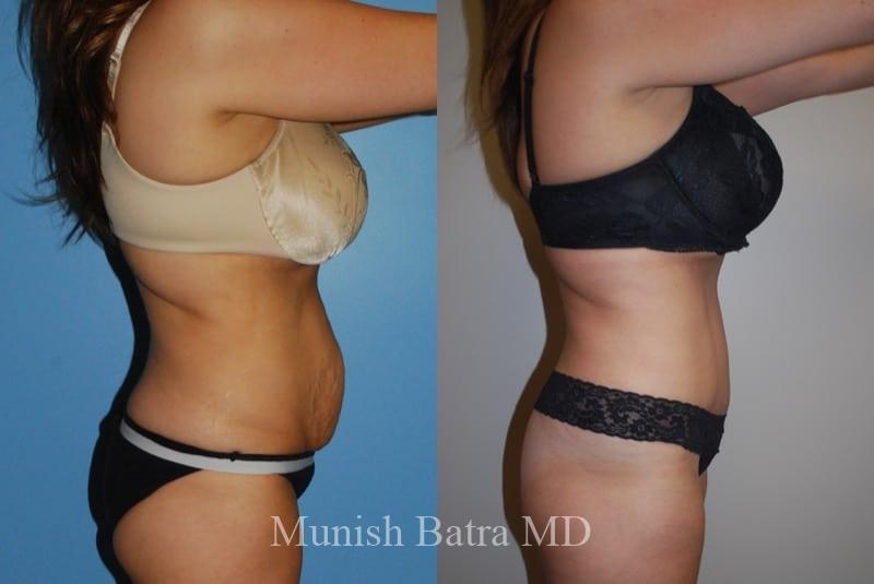 Before and After Image