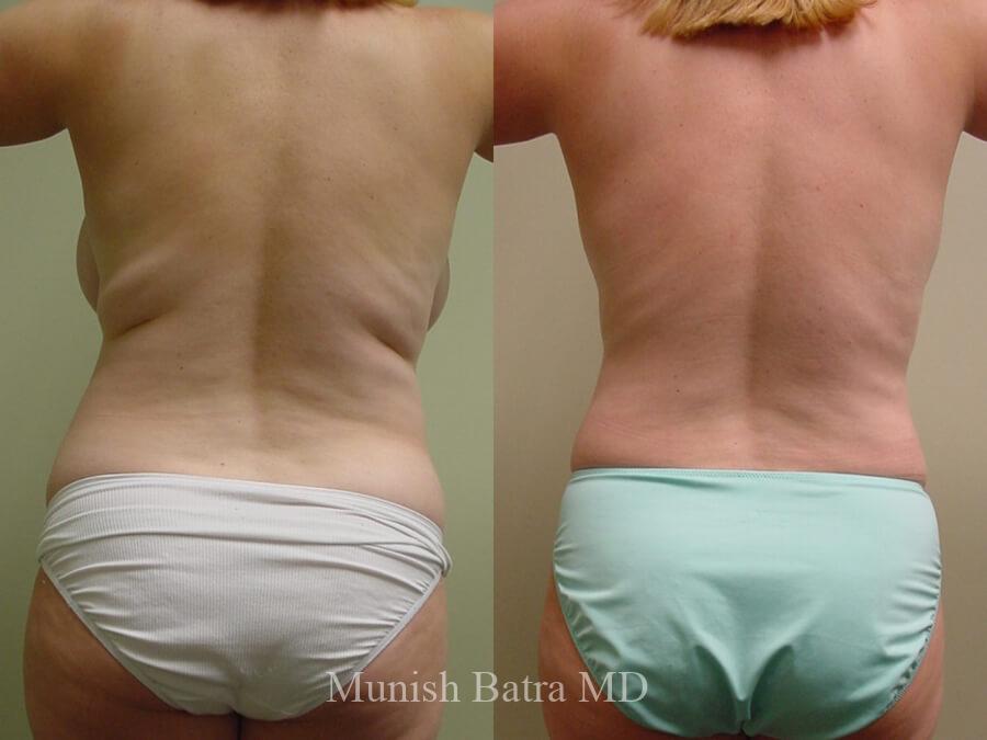 Before and After Image