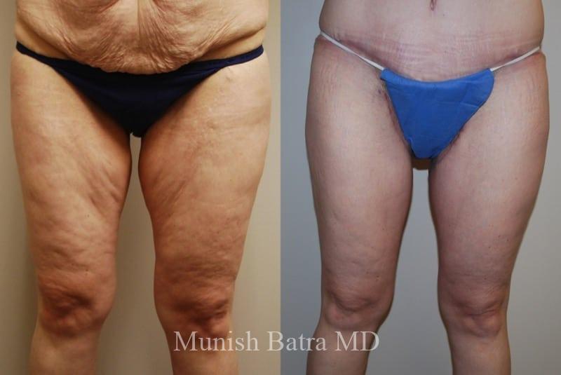 Before and After Image