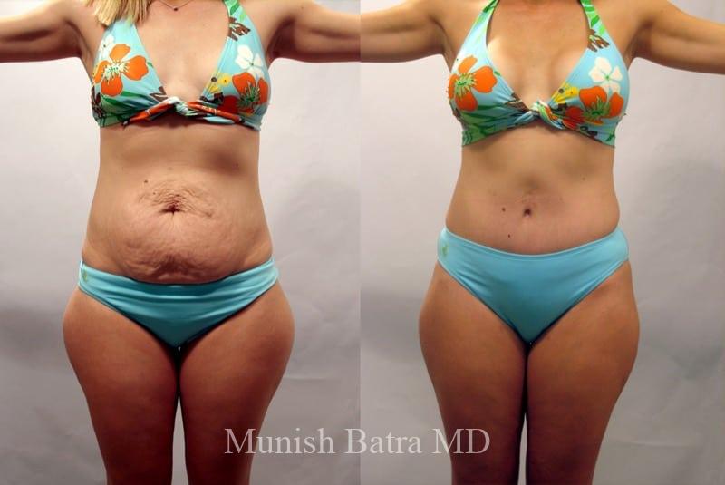 Before and After Image