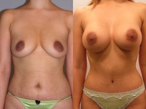 Before and After Image